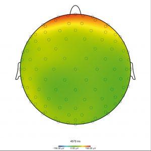 Figure 1A: Map displaying the electrode positions