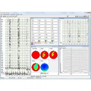 BrainVision RecView