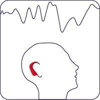 Auditory Brainstem Potentials