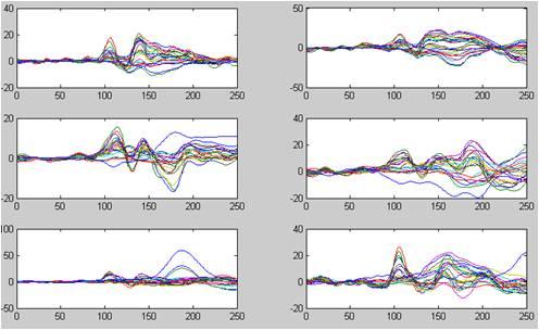 Figure 5 MATLAB transform