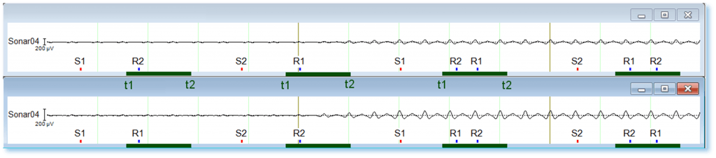 Figure 1. Support Tip: ABE