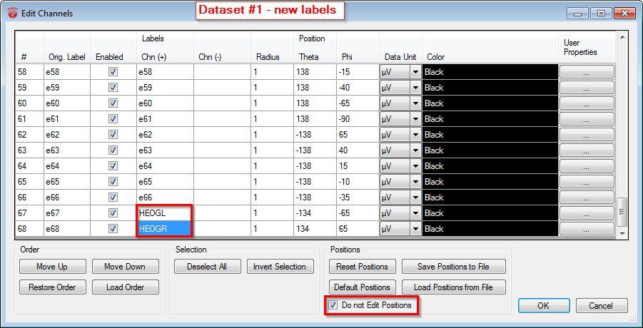 Figure 5A. Support Tip: Edit Channels