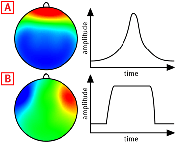 Figure 1 Ocular Correction ICA 