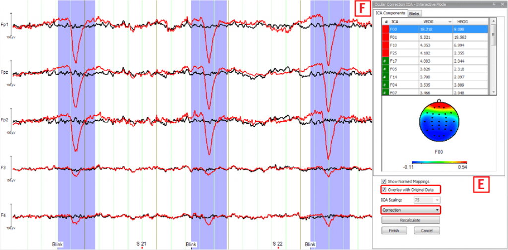 Figure 4 Ocular Correction ICA 
