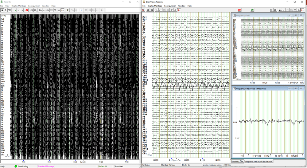 BrainVision RecView - screenshot 3