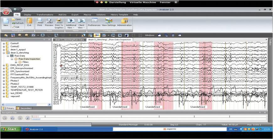 Figure 2: Analyzer 2.0 in VMware mode in full screen image