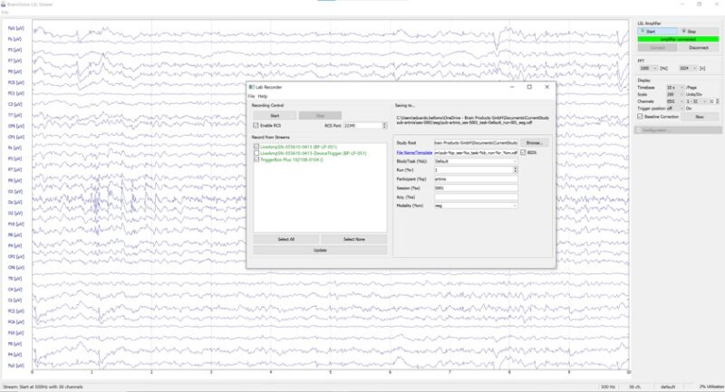 EEG-fNIRS Cookbook - Figure 7 (2)