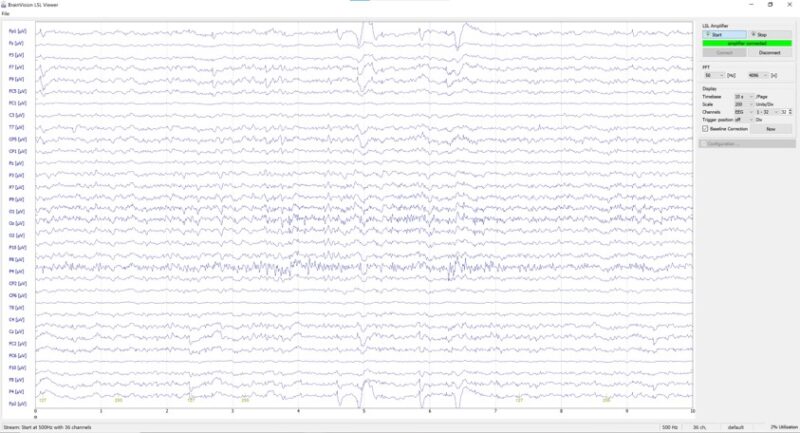 EEG-fNIRS Cookbook - Figure 7 (3)